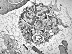 M,2w. | bacteriaemia - phagocytosed microbes M,2w. | bacteriaemia - phagocytosed microbes